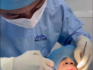 TẨY TRẮNG RĂNG KHÔNG Ê BUỐT, HIỆU QUẢ TẠI NHA KHOA ÂN ĐỨC