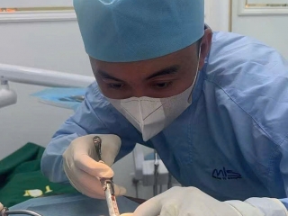 Hoàn thành 2 trụ Implant cho khách hàng từ Indonesia – Niềm tin vượt biên giới