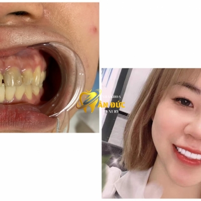 khách hàng tai nha khoa Ân Đức 10