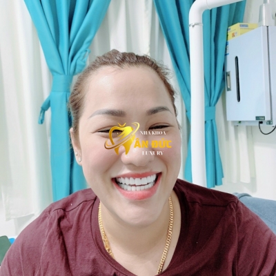 KHÁCH HÀNG TẠI NHA KHOA ÂN ĐỨC