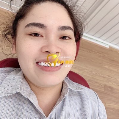 KHÁCH HÀNG TẠI NHA KHOA ÂN ĐỨC